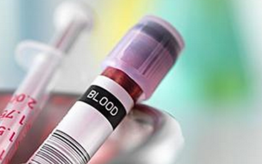 體外診斷行業(yè)前景分析